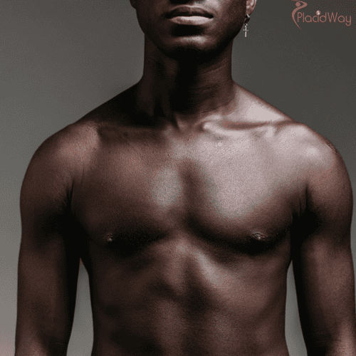 Learn about Pectoral Augmentation in New Delhi, India